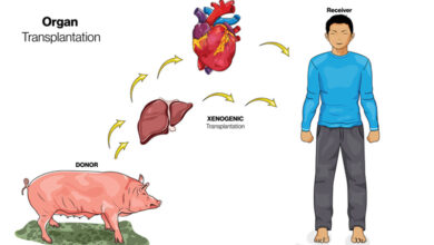 transplant pig liver into human